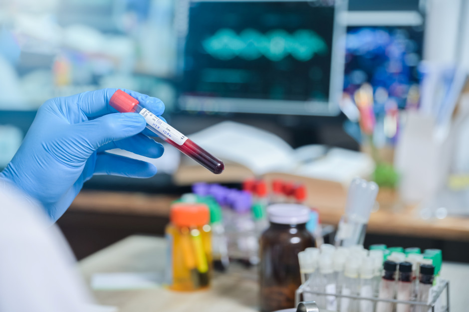 Zakażenie HIV można skutecznie kontrolować. W profilaktyce Polska wciąż ma zaległości