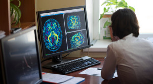 AI wkroczy do diagnostyki w szpitalach. Ministerstwo Zdrowia wskazało narzędzia dla lekarzy