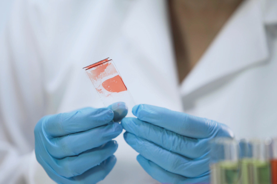 Terapia podskórna dla pacjentów z hemofilią ograniczona. Wciąż nie ma decyzji