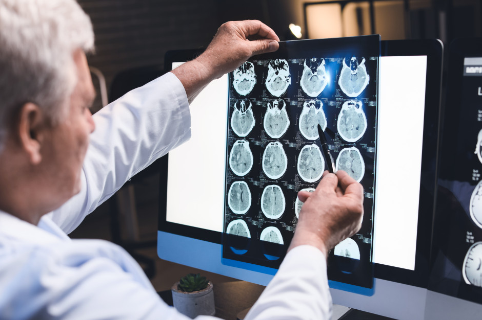 Neurolog: napędza rozwój alzheimera. Robimy to sobie przez lata