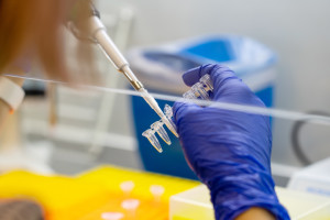 Nier&oacute;wny dostęp do diagnostyki wpływa na losy pacjent&oacute;w. "Karta e-DiLO pokaże wszystko na żywo"