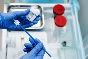 Uprawnienia położnych a cytologia. Ministerstwo Zdrowia upraszcza wymagania